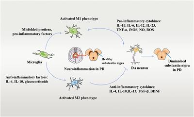 Levodopa-induced dyskinesia: interplay between the N-methyl-D-aspartic acid receptor and neuroinflammation